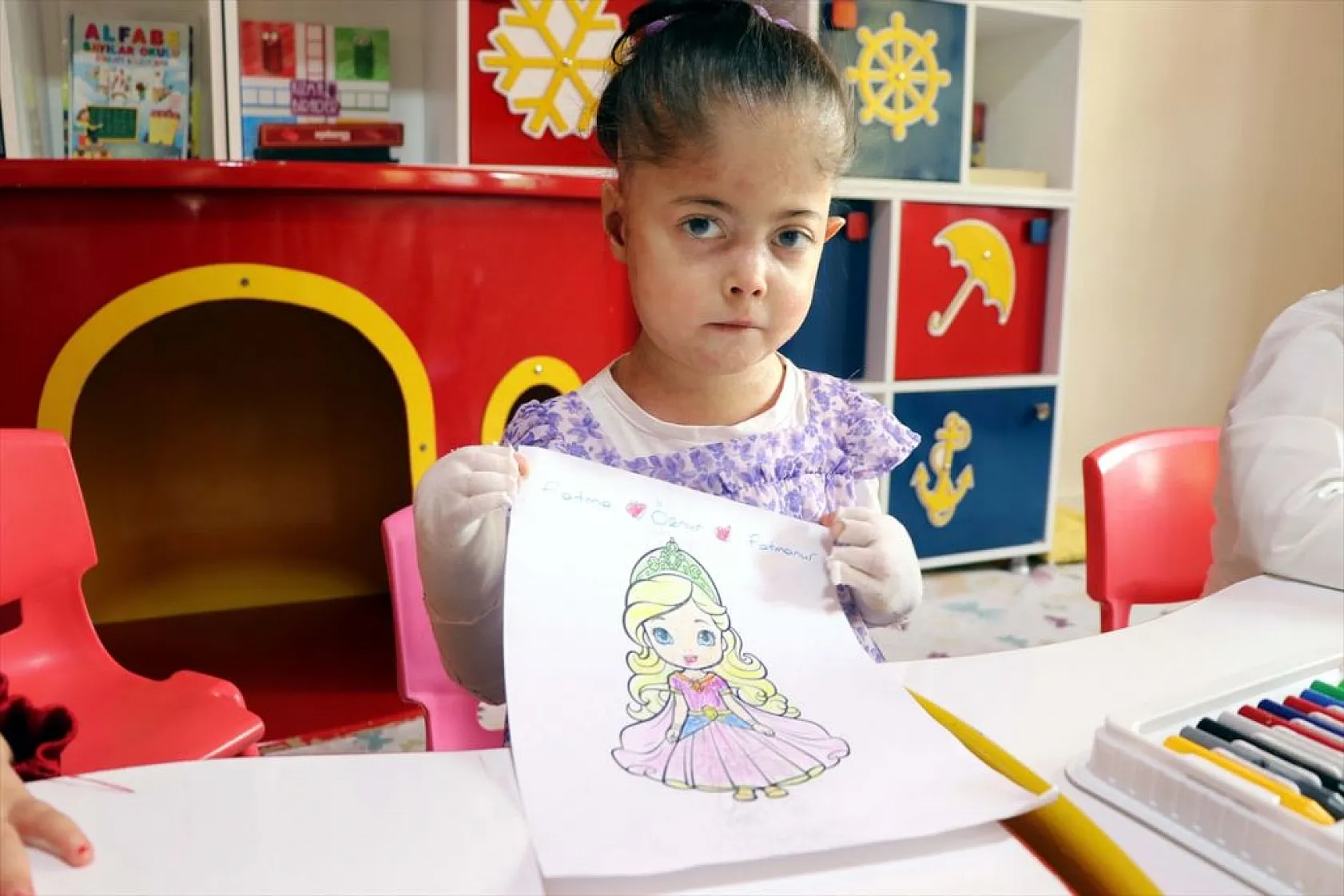 'Kelebek hastası' çocuğun hayali gerçek oldu