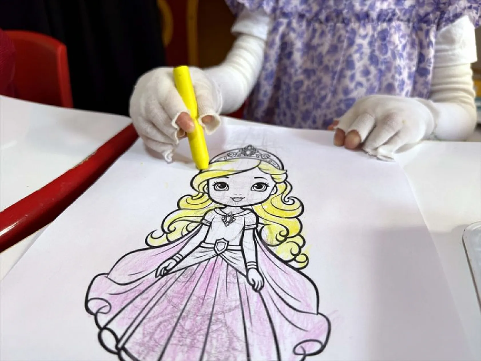 'Kelebek hastası' çocuğun hayali gerçek oldu