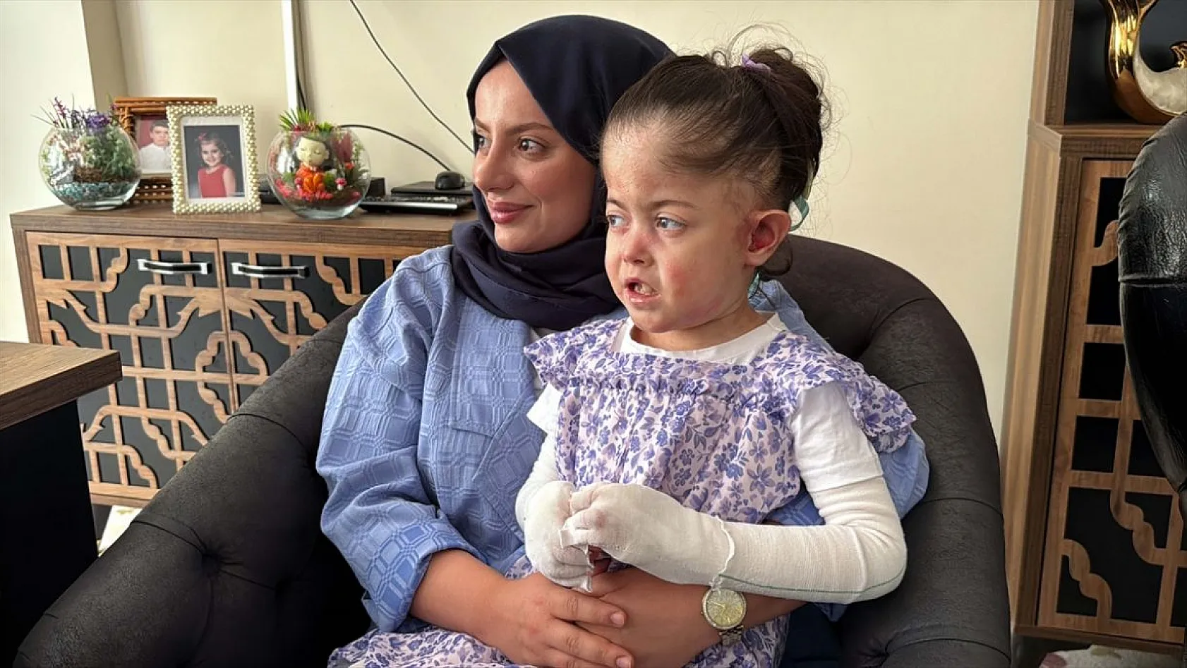 'Kelebek hastası' çocuğun hayali gerçek oldu