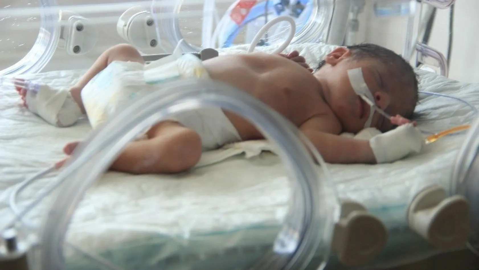 Öldürülen annesinin karnından alınan bebek Erzurum'da tedavi altında
