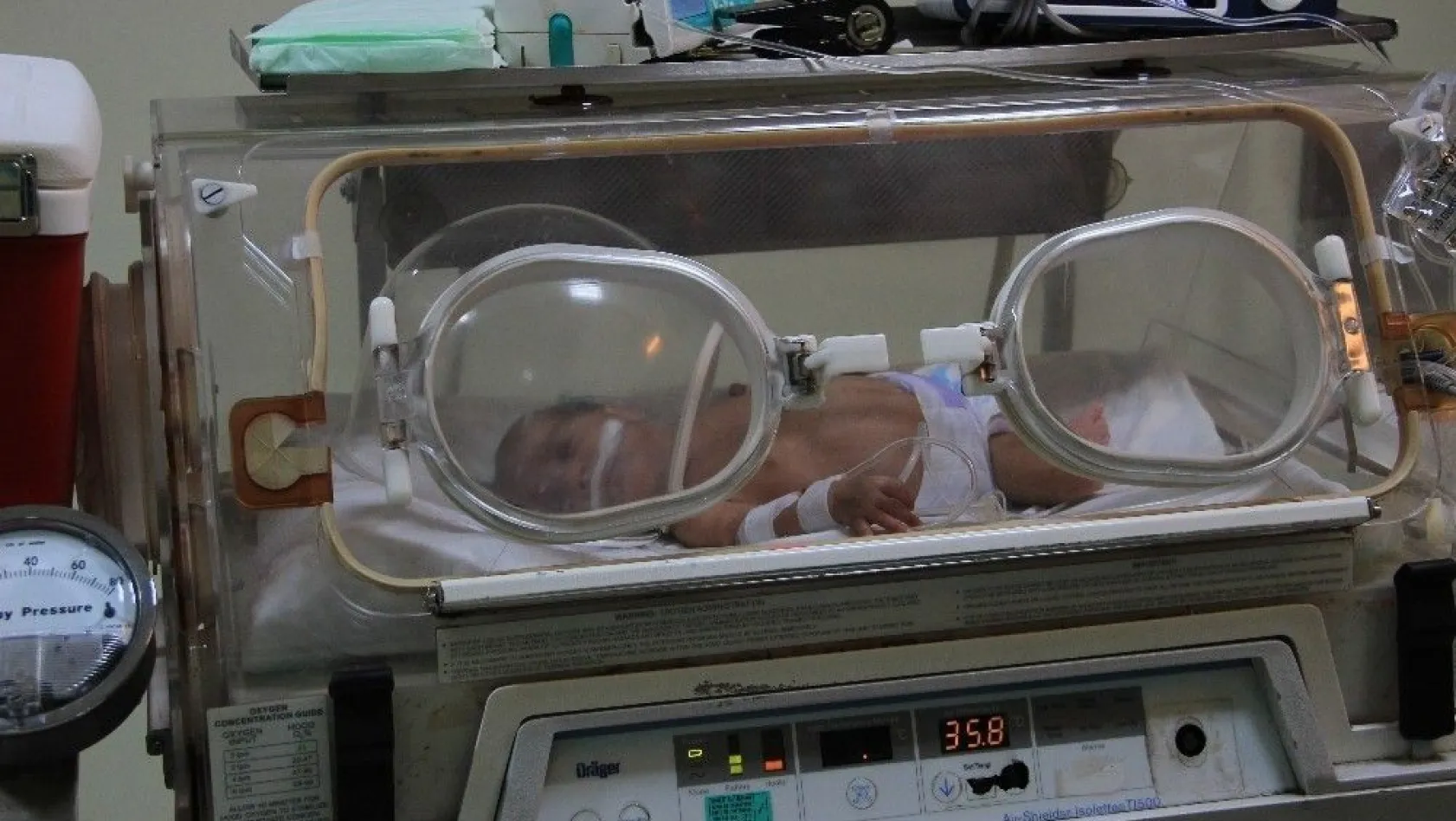 800 gram doğan Ömer Pusat bebek 3 santimetrelik kesi ile hayata tutundu
