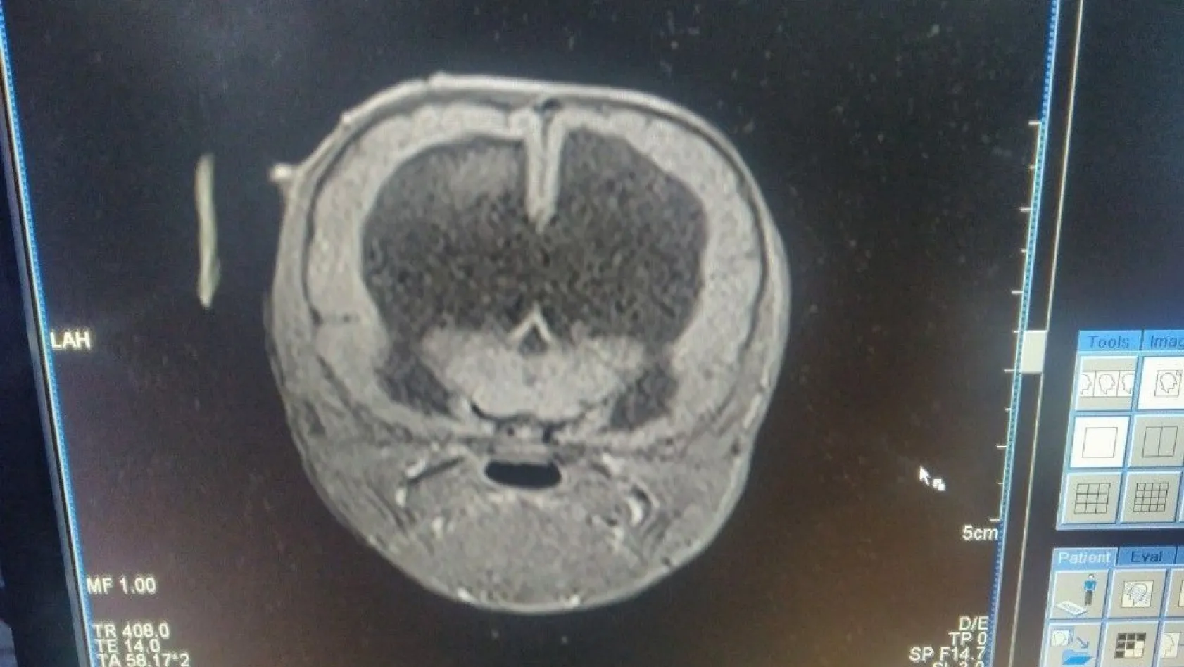Yavru Kangal beyin ameliyatı ile dengesine kavuşacak
