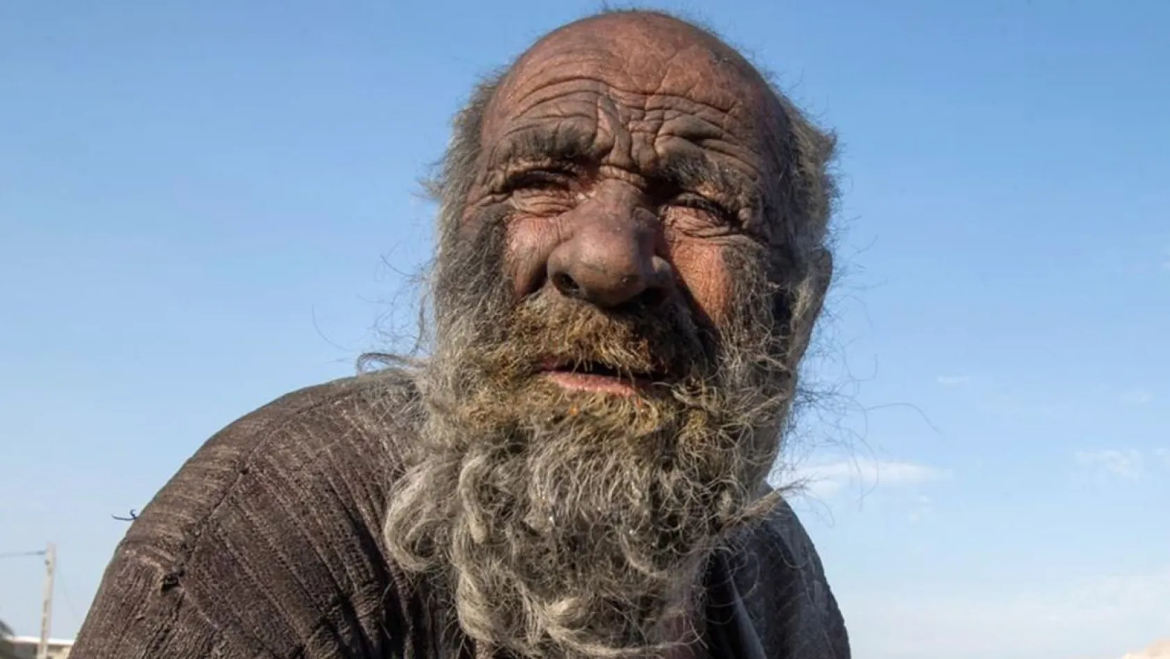 70 yıldır yıkanmayan Hacı Amca, duş alınca hayatını kaybetti