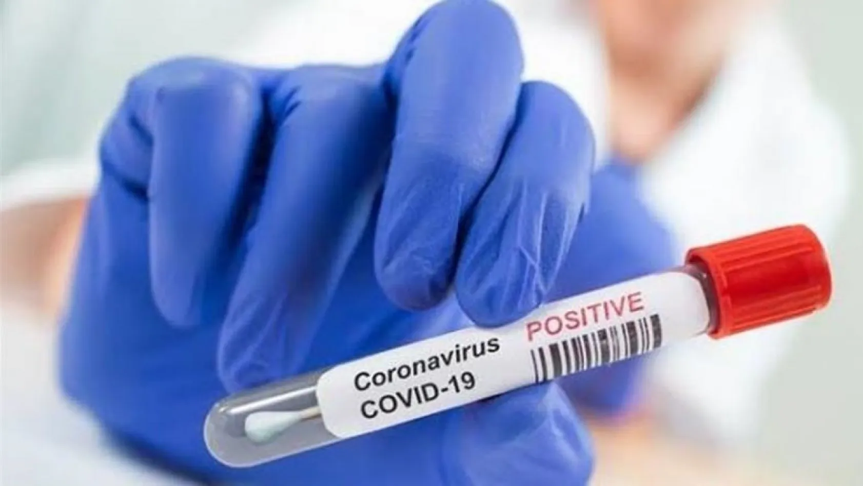 'Covid-19 pandemisi tüberküloz ölümlerini arttırdı'