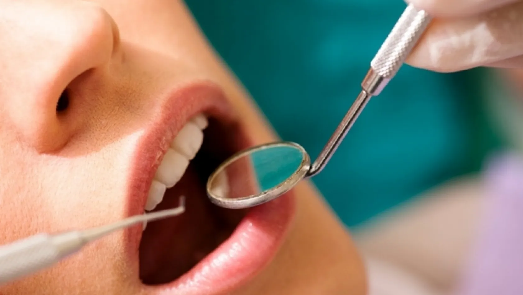 Çürüyen dişler başka hastalıkları tetikliyor