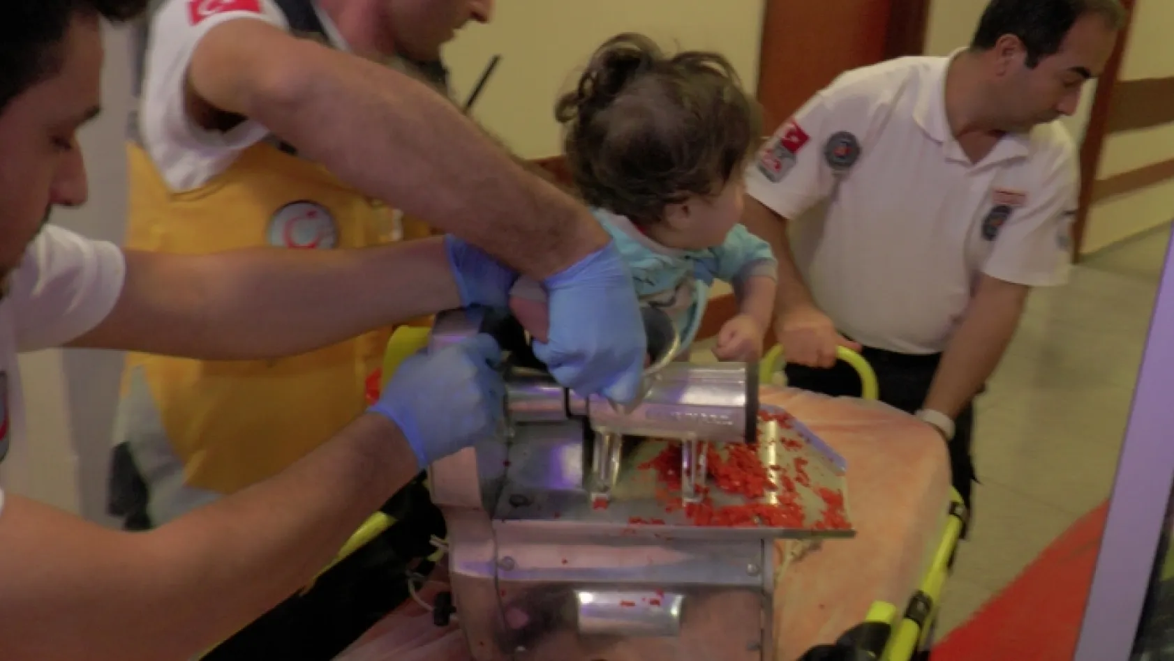 1 yaşındaki çocuk kolunu kıyma makinesine kaptırdı
