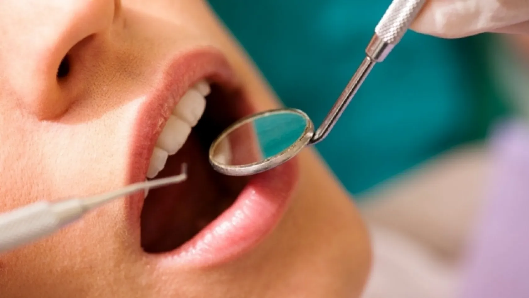 Diş problemleri hayatınızı etkilemesin