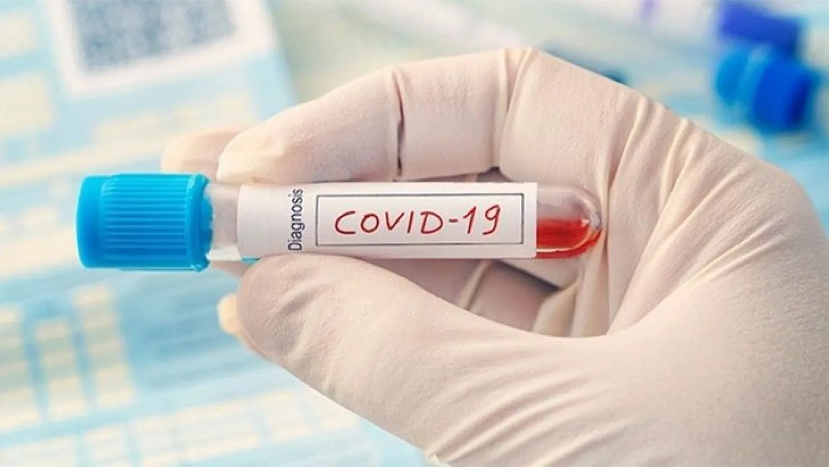 İşte Covid-19'a karşı daha dirençli kan grupları