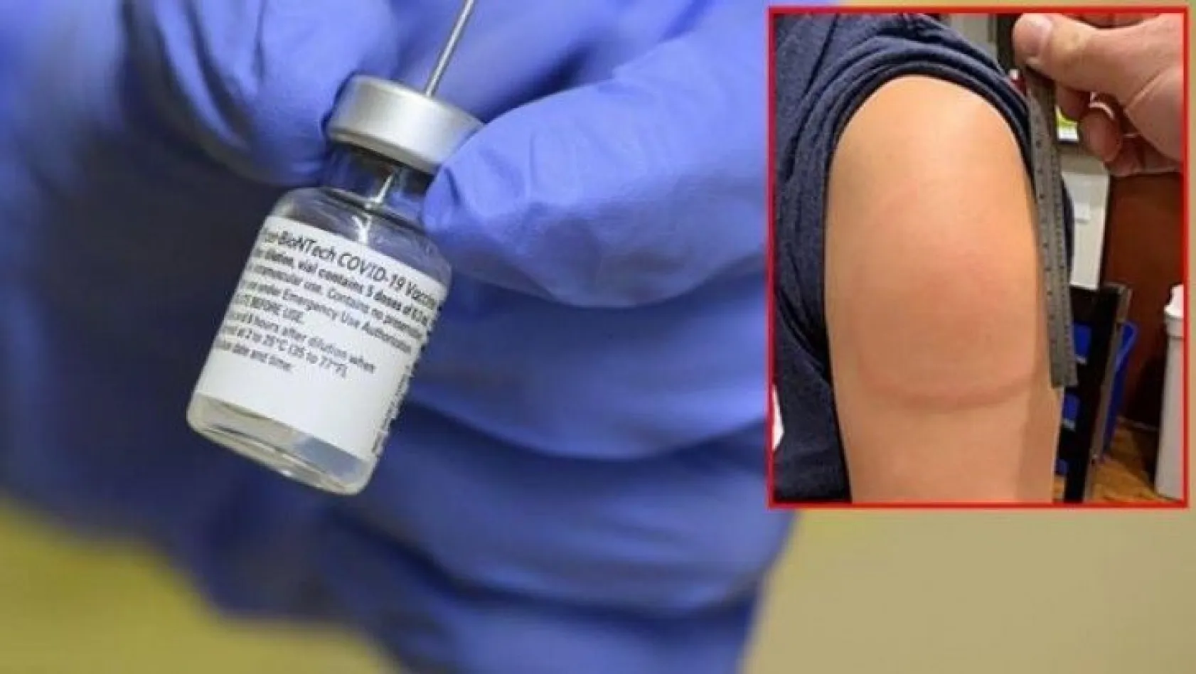 Koronavirüs aşısında bir yan etki daha