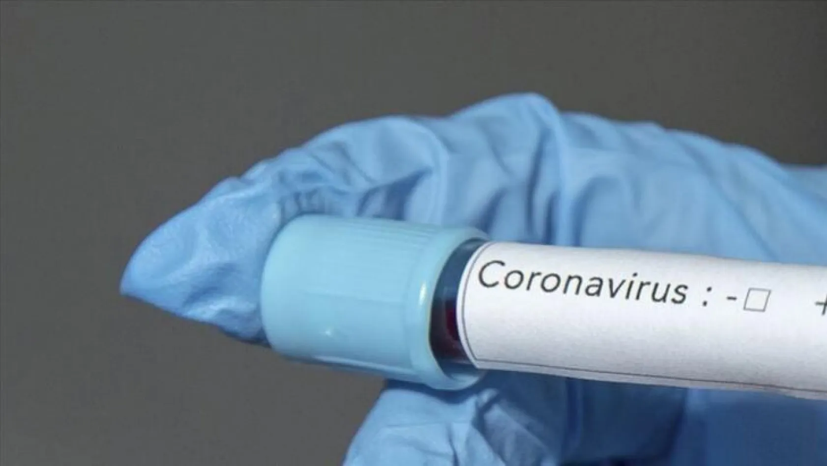 Koronavirüs vaka sayılarında son durum...