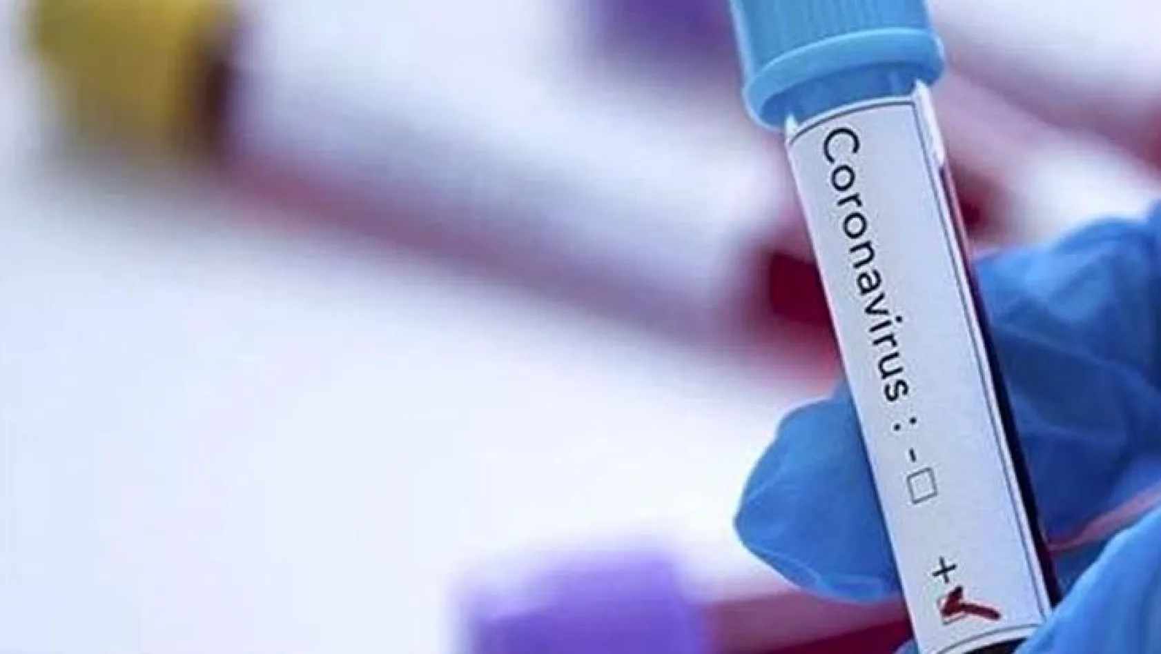 Koronavirüsten 552 bin ölüm, 12 milyondan fazla vaka...