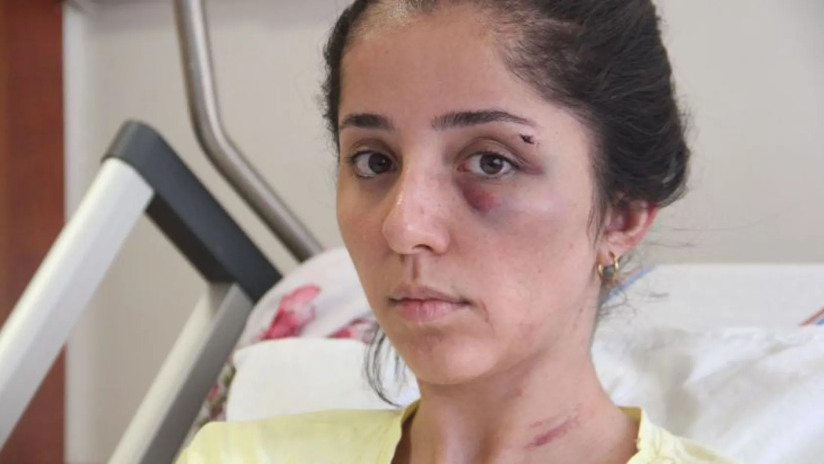 Elazığ'da kadına şiddet!