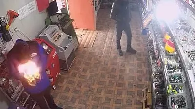 Çakmağı çakınca yüzü alevlerin arasında kaldı