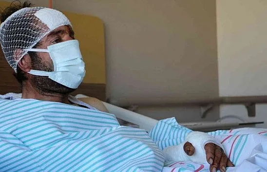 Ayı saldırısına uğrayan şahıs, dehşet anlarını anlattı