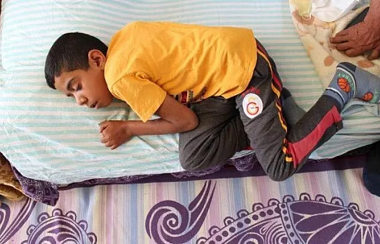 Bir gözünü kaybetti, 10 ameliyat geçirdi, 2 operasyonu kaldı