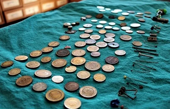 Çocukların midesinden bakın neler çıktı