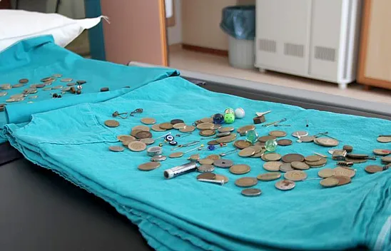 Çocukların midesinden çıkanlar hayrete düşürdü