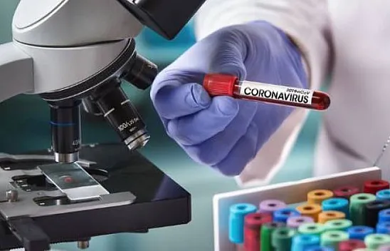 Kovid-19 haftalık vaka sayısı açıklandı!