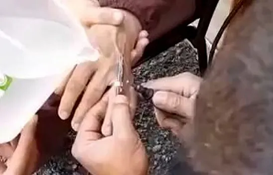 Parmağına yüzük sıkıştı, itfaiye ekipleri kurtardı