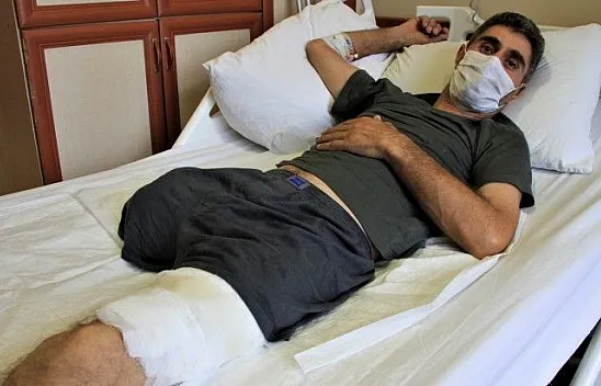 Tek bacağını kaybetti şimdi protez bacak bekliyor