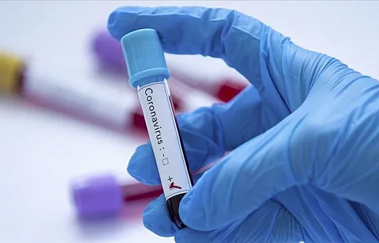 Vaka sayıları rekor üstüne rekor kırıyor