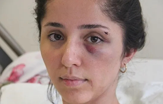 Kendisini bu hale getiren doktor sevgilisinden şikayetçi olmadı