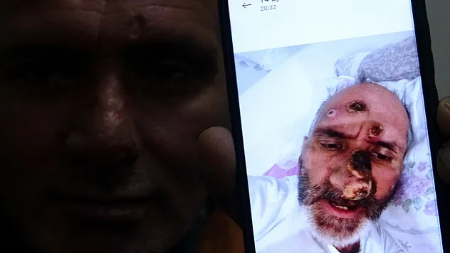 Afrika sineğinin ısırmasıyla tanınmayacak hale geldi!