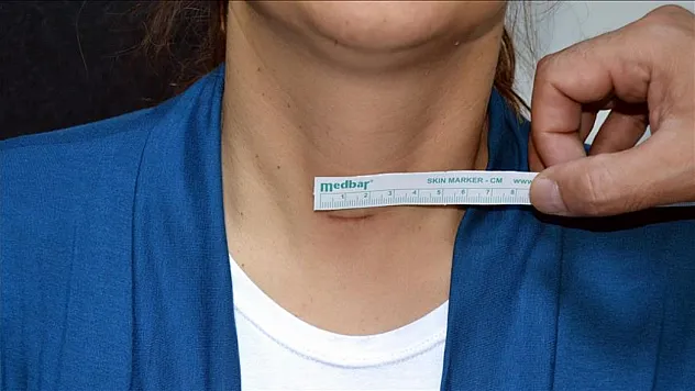 Tiroit hormonları hakkında uzman görüşü