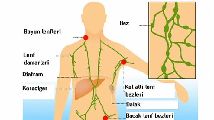 Lenf bezi şişmesi, büyümesi, nedenleri, belirtileri ve tedavisi