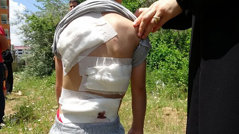 Başıboş köpekler çocuğa saldırdı