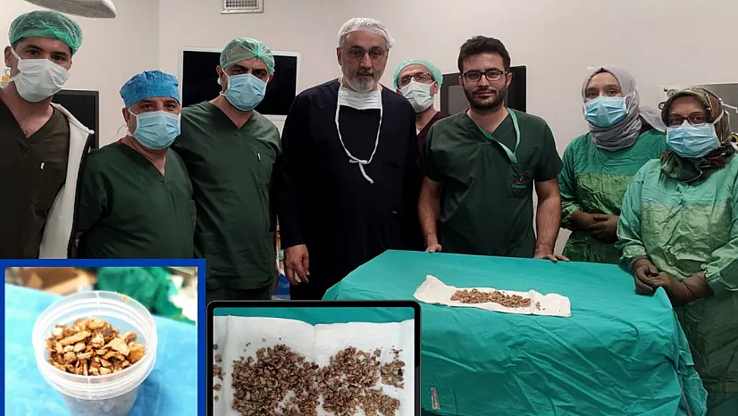 Kapalı böbrek taşı ameliyatı ile sağlığına kavuştu